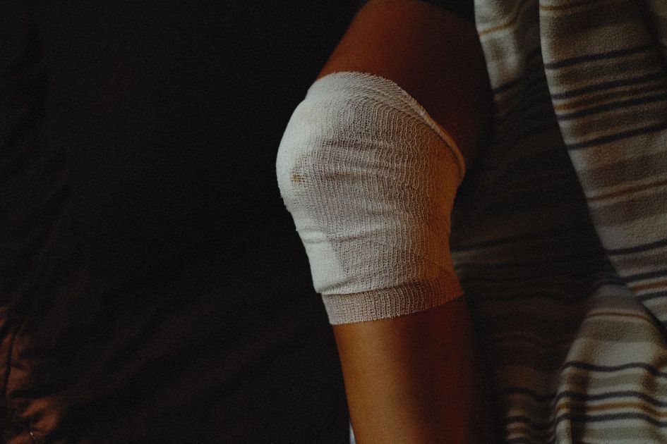Agresión con fractura de pómulo deja a hombre de 57 años herido en Tacna